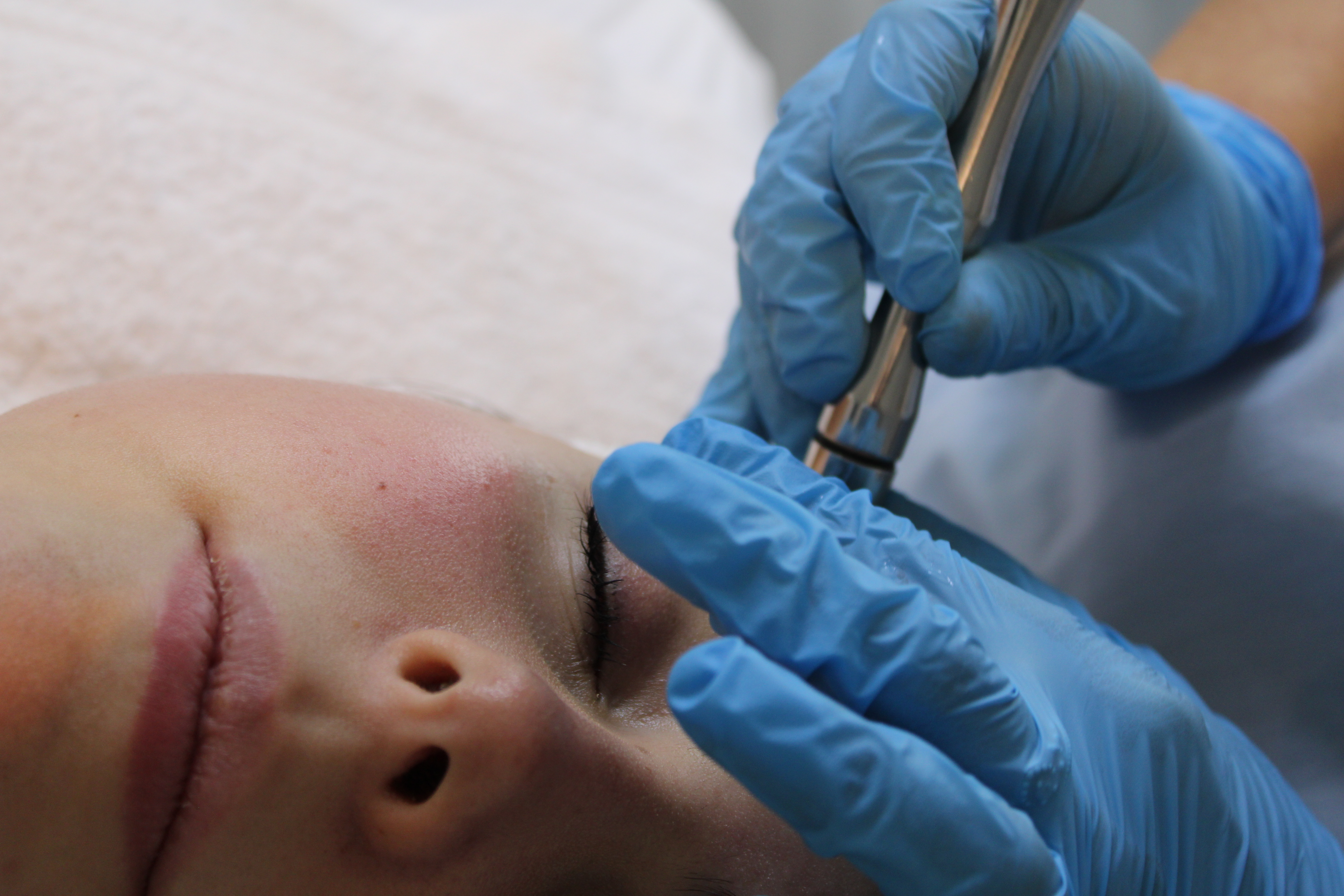 Limpieza Facial Profunda