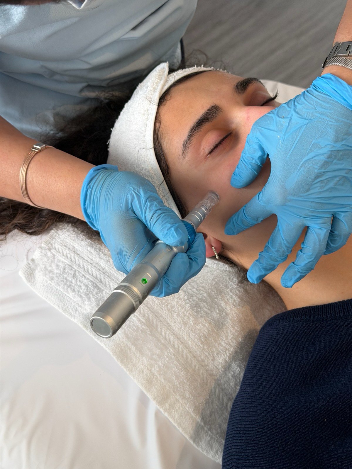 Dermapen con Exosomas